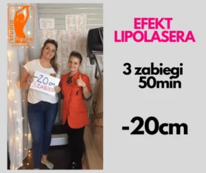 lipolaser