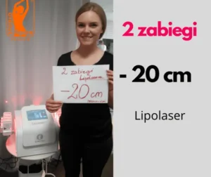 lipolaser