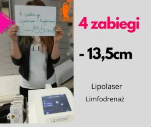 lipolaser