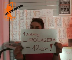 lipolaser