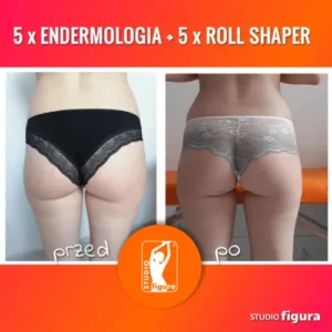 endermologia