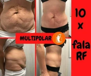 fala