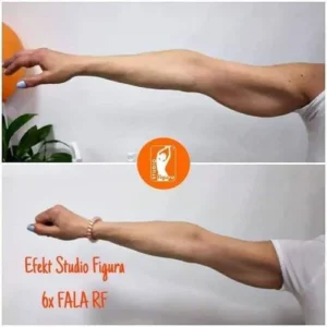 fala