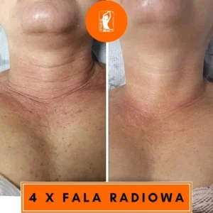 fala