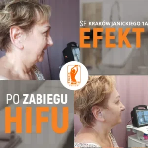 hifu