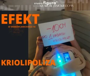 kriolipoliza