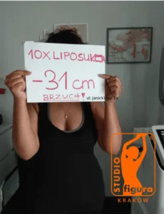liposukcja