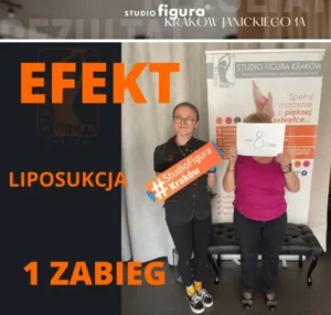 liposukcja