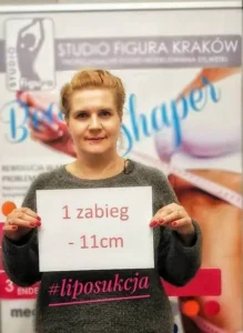 liposukcja